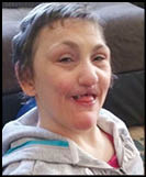 A young girl with a cleft lip and palate sits on a couch. Description generated by AI